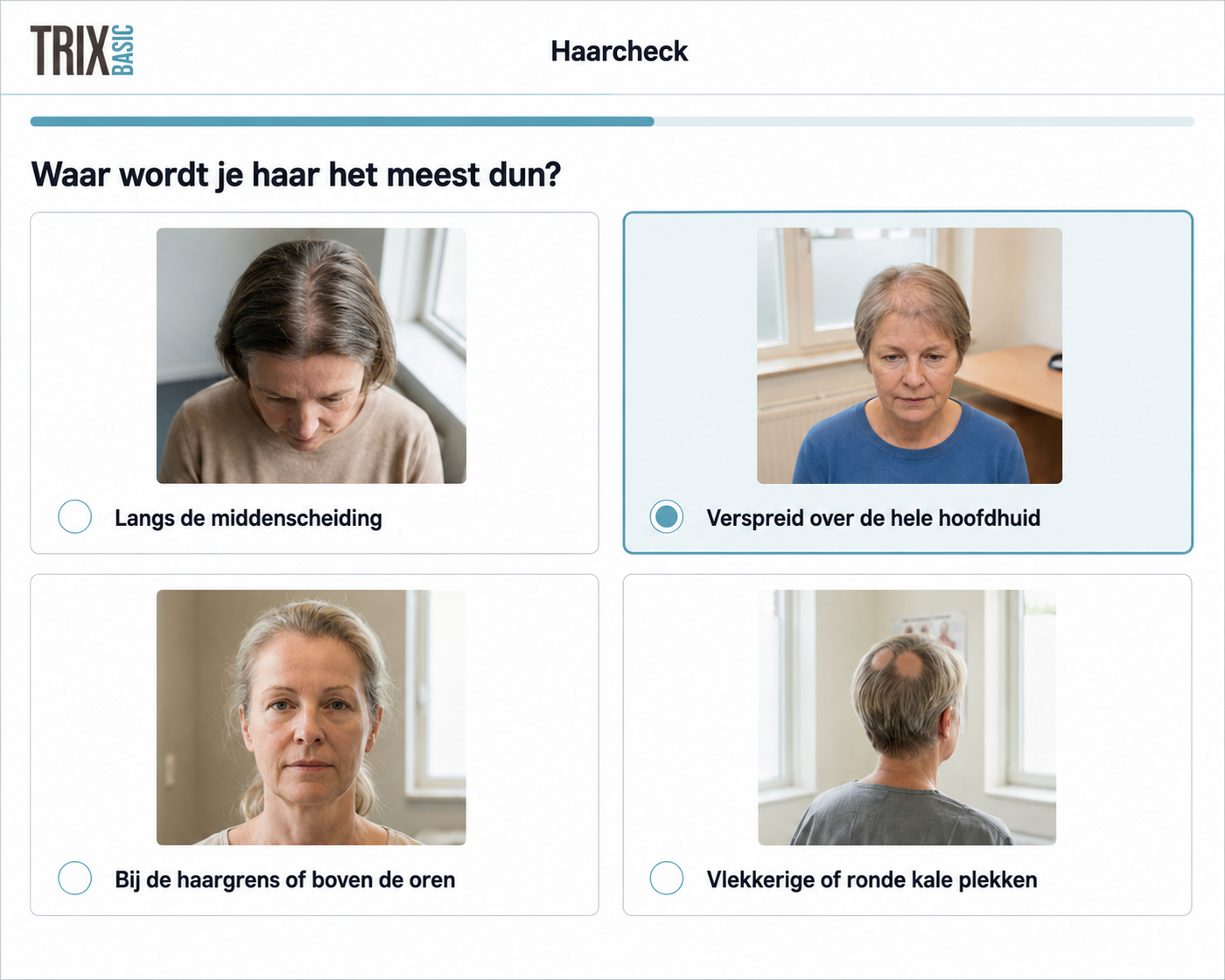 TRIX Hair Check met antwoordopties voor verschillende patronen van haarverlies.
