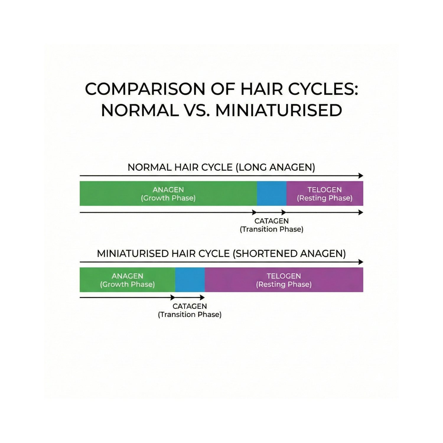 Schema van de haarcyclus met verkorte anagene fase bij folliculaire miniaturisatie in alopecia androgenetica.