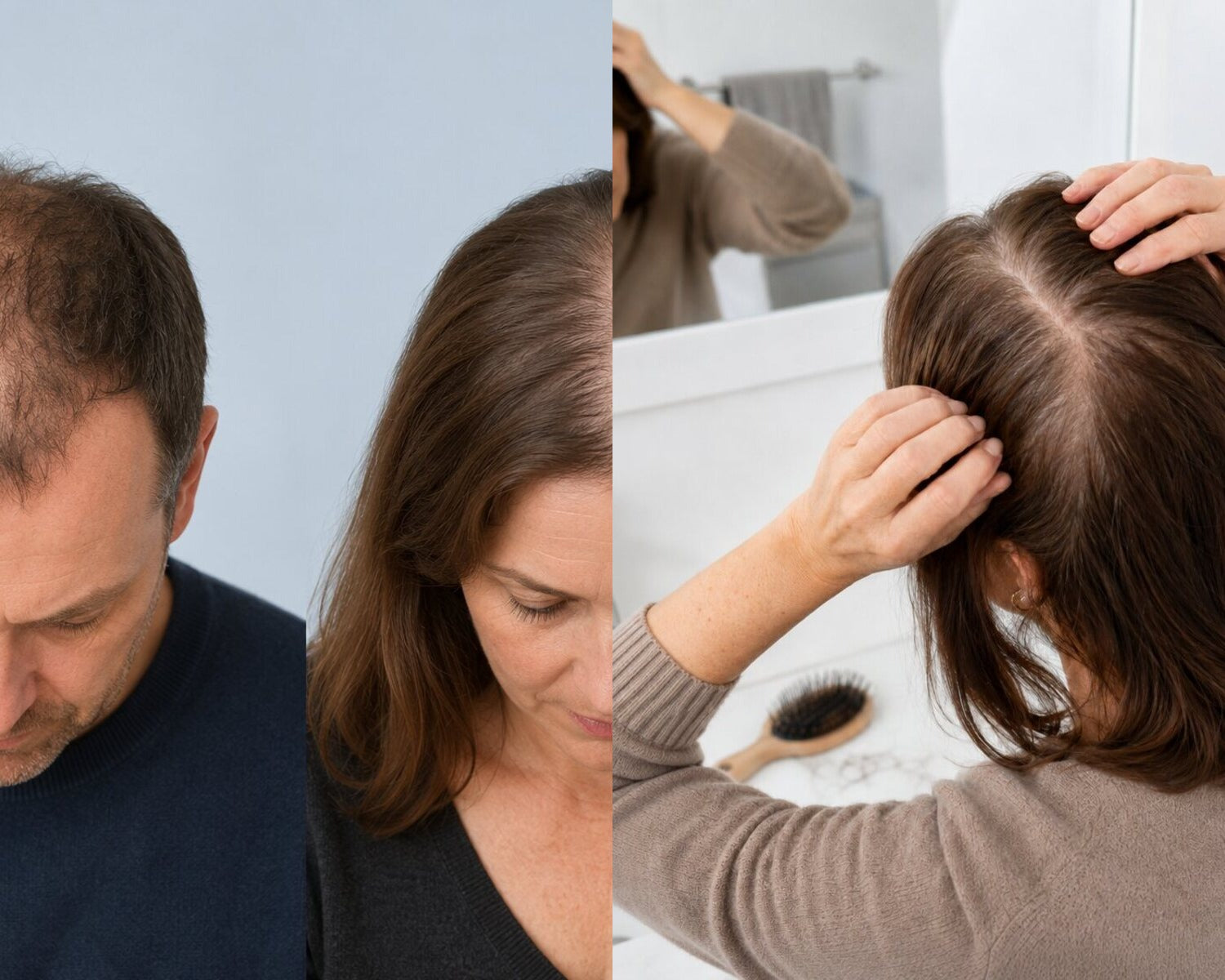 Vergelijking van patroongebonden haarverdunning en diffuse haaruitval