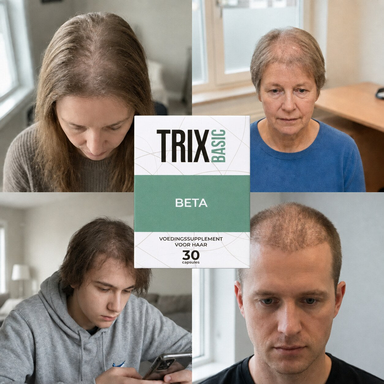 TRIX Basic Beta bij diffuse haaruitval passend bij telogeen effluvium bij mannen en vrouwen.
