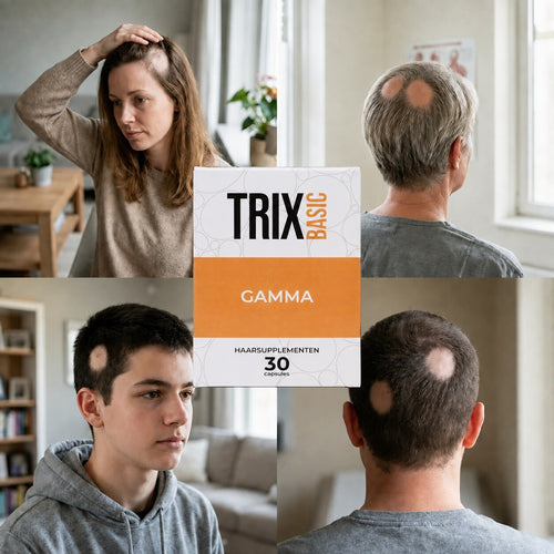 TRIX Basic Gamma for localized bald patches consistent with alopecia areata in men and women.