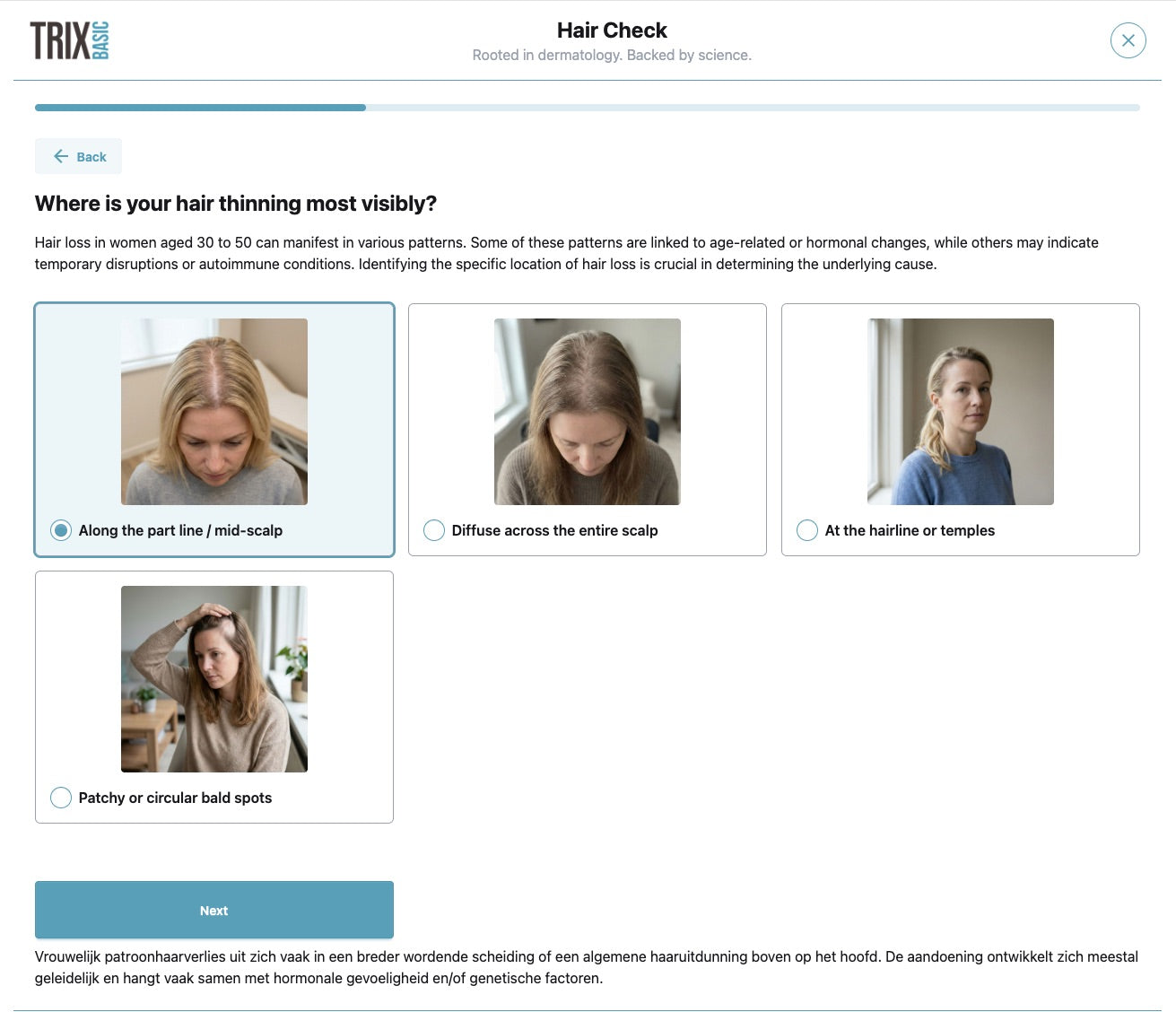 Digitale beoordeling van haarverlies via TRIX Hair Check