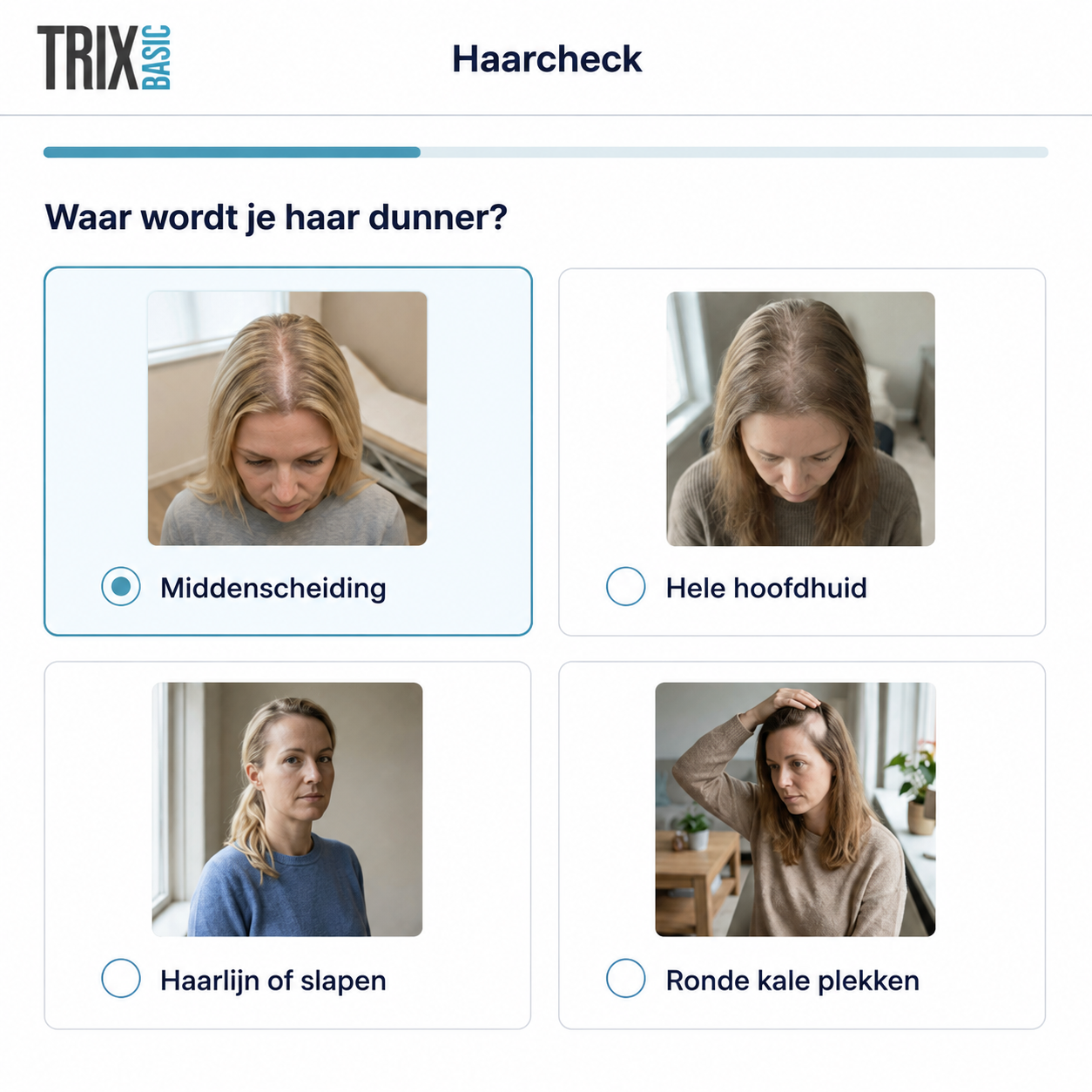 TRIX Hair Check met vier mogelijke patronen van haarverlies bij vrouwen.