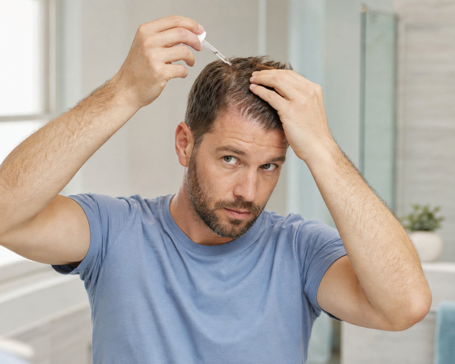 Man applies scalp lotion specifically to the dry scalp at the crown